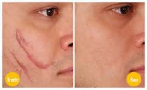 [Image: dieu-tri-seo_zpsd82993e3.jpg]