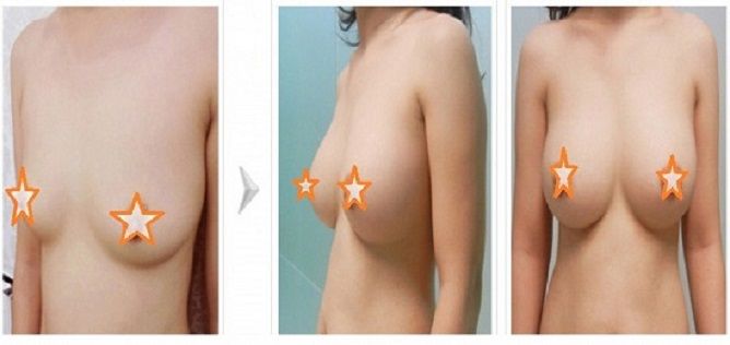 [Image: nang-nguc-noi-soi-o-dau-dep_zps27e52d17.jpg]